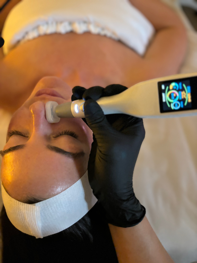 Jet Plasma Facial