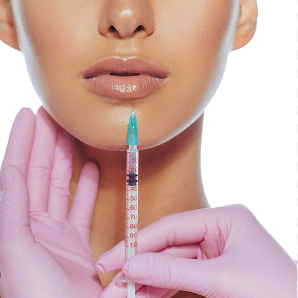 Lip Filler at Grace Infused Wellness & Aesthetics in Broken Bow, OK