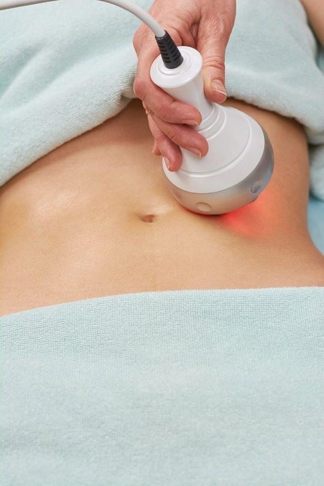 Ultrasonic Cavitation therapy