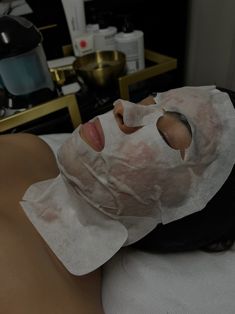 C02 Carboxy Therapy Facial