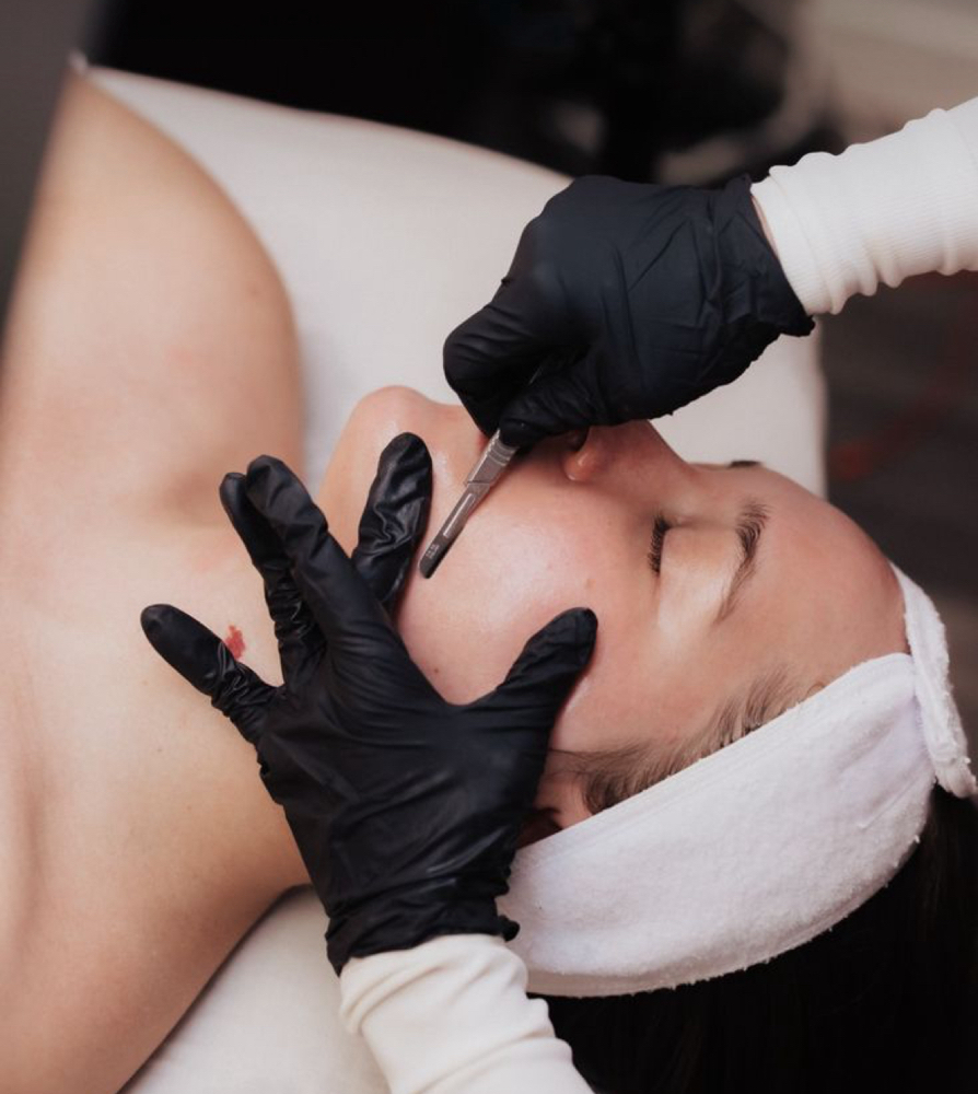 Dermaplaning Facial