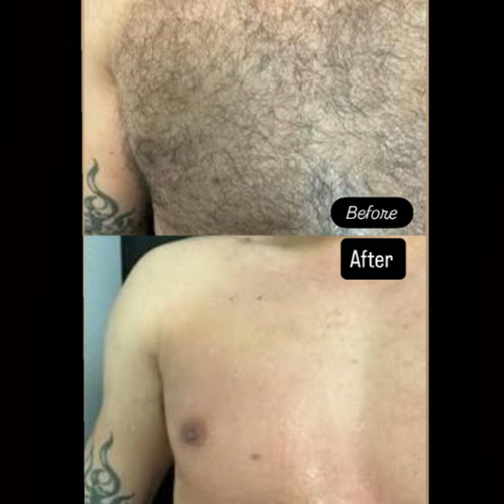 Chest Wax at Queensmade Esthetics in Wilmington, NC