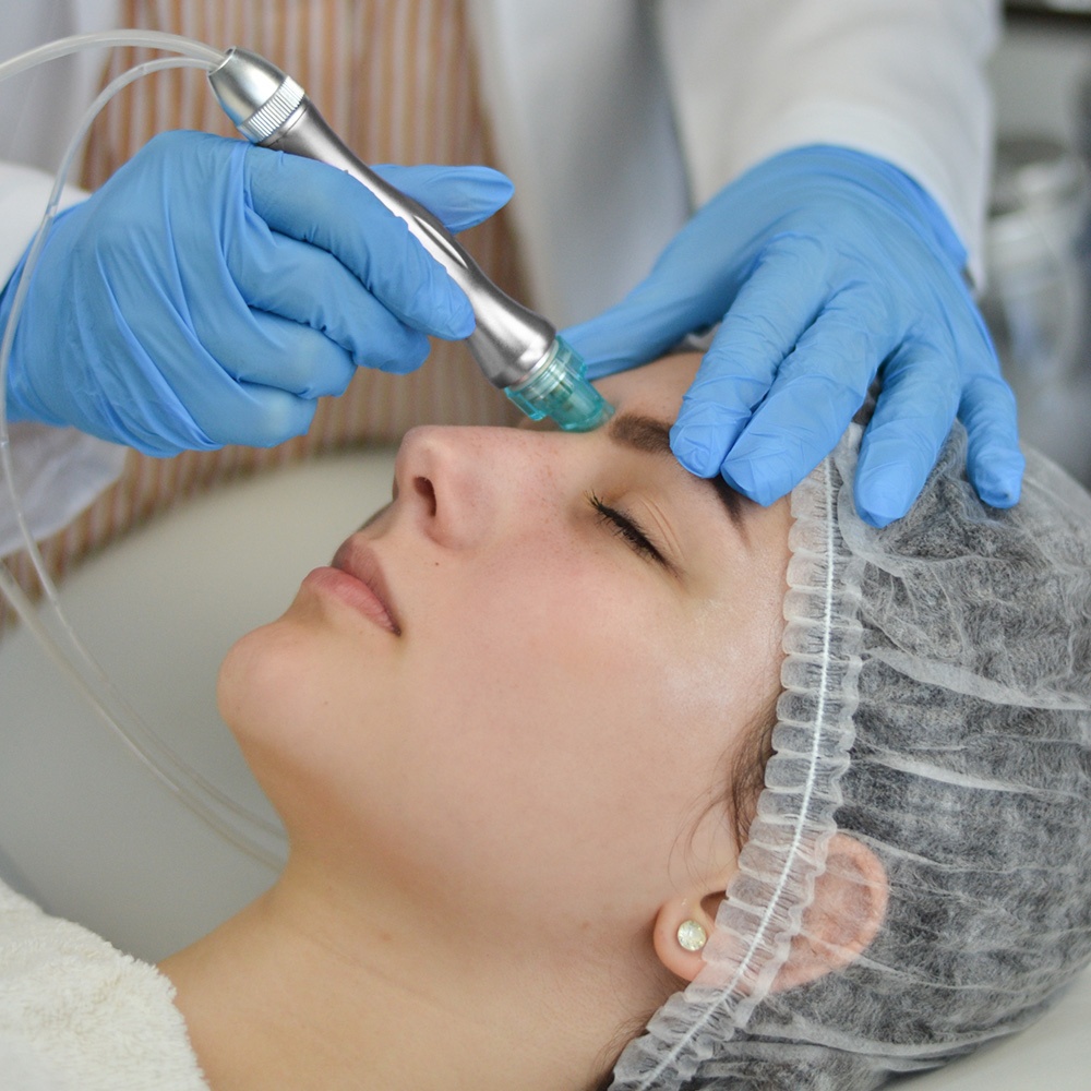 Hydrodermabrasion Facial