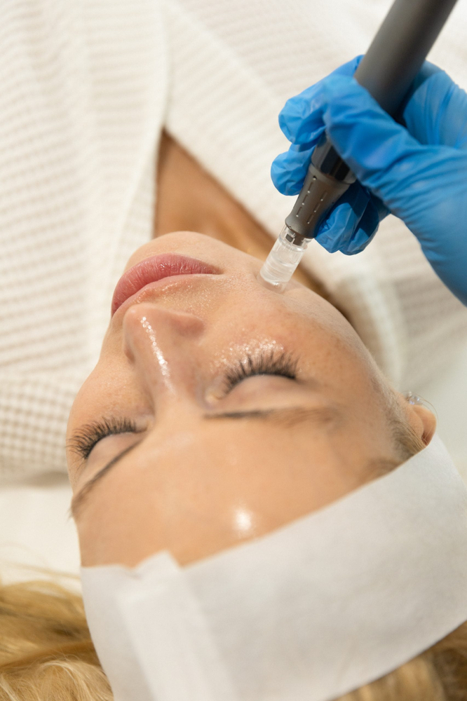 Advance Exfoliation Add On