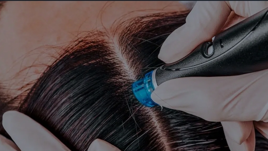 HydraFacial Scalp Cleanse