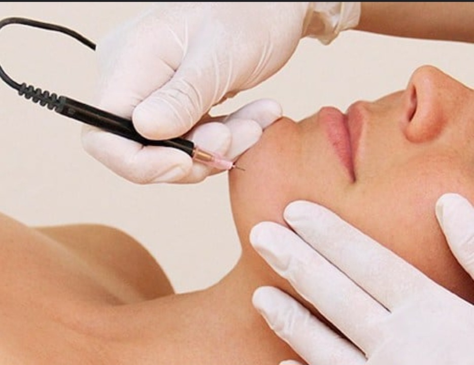 Electrolysis - 15 Minutes
