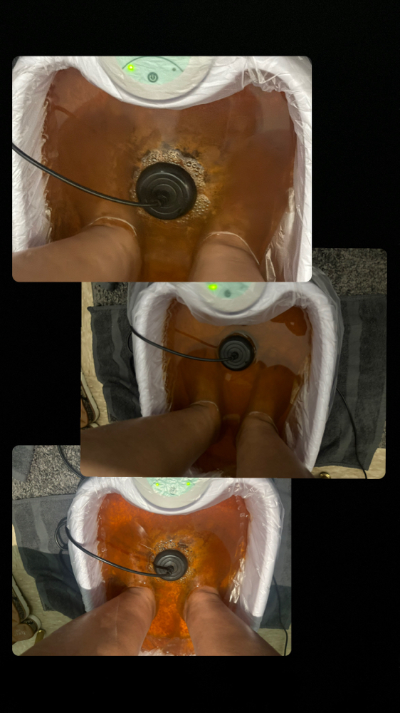 Ion Detox