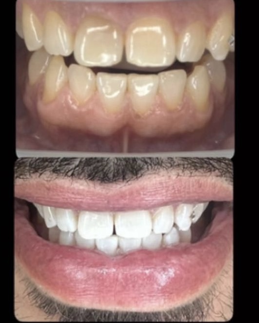 Sensitive Teeth Package  🦷✨