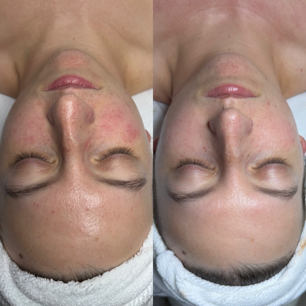 Level 2 - Advanced at The Skinfidence Collective in St. Clair Shores, MI