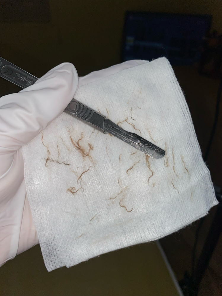 Dermaplane Glow at Darely Esthetics in Pittsburg, CA