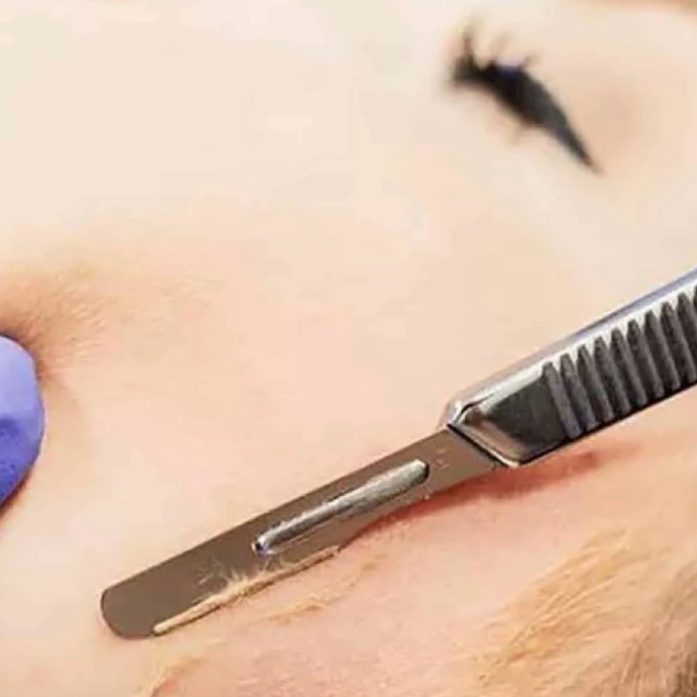 Dermaplaning at Beyond the Skin in North Chelmsford, MA