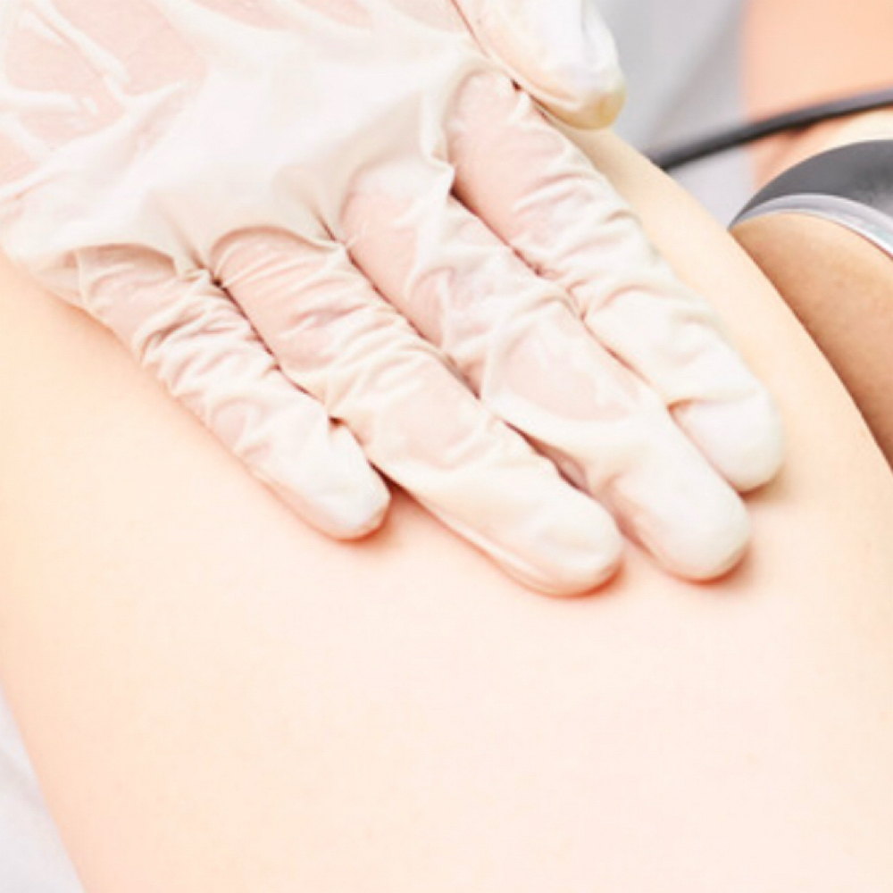 Cavitation Arms at Refresh Ur Image Beauty Bar and Spa in Alta Loma, CA