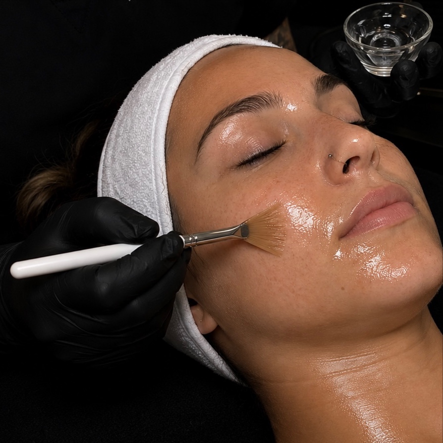 Chemical Peel + LED Red Light at BSE NORTH in Leander, TX