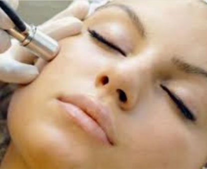 Microdermabrasion With Facial