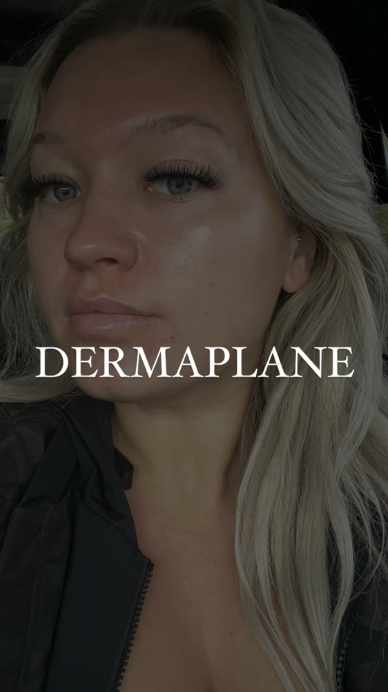 Dermaplaning