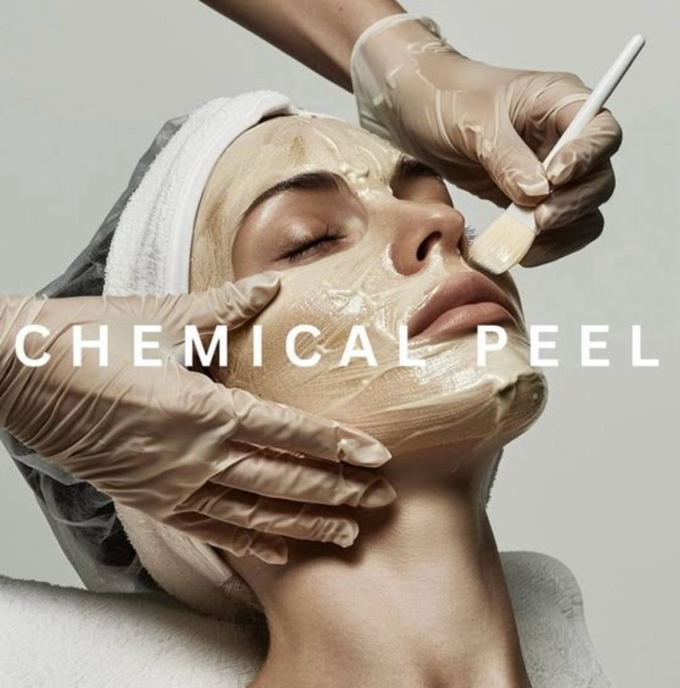 Peel Treatments at Magnolia Skin & Nails in LaGrange, IL