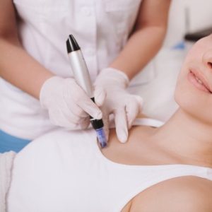 Microneedling Neck And Décolleté at Leidy Bedoya in Methuen, MA