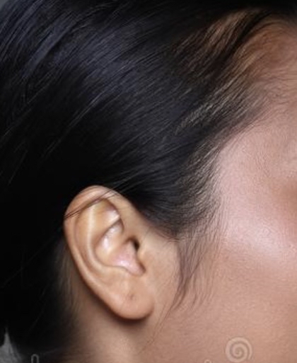 Sideburn