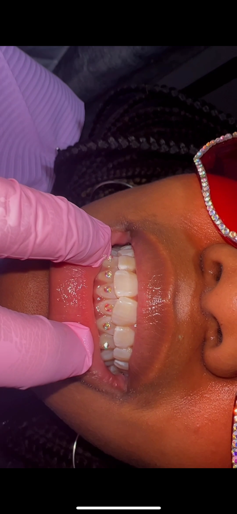 Tooth Gems at Jens Final Touch Esthetics in Hagerstown, MD