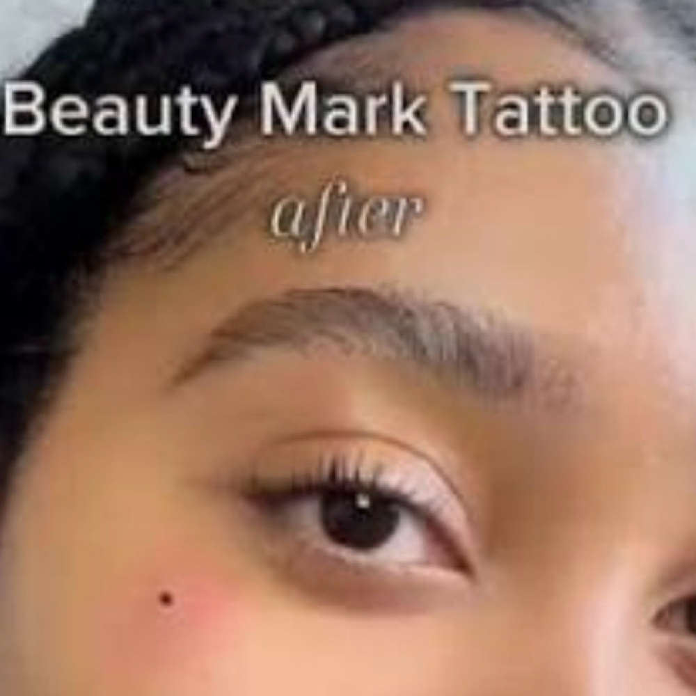 Beauty Make Mole at Beat-iFul Aesthetics in Hollywood, FL