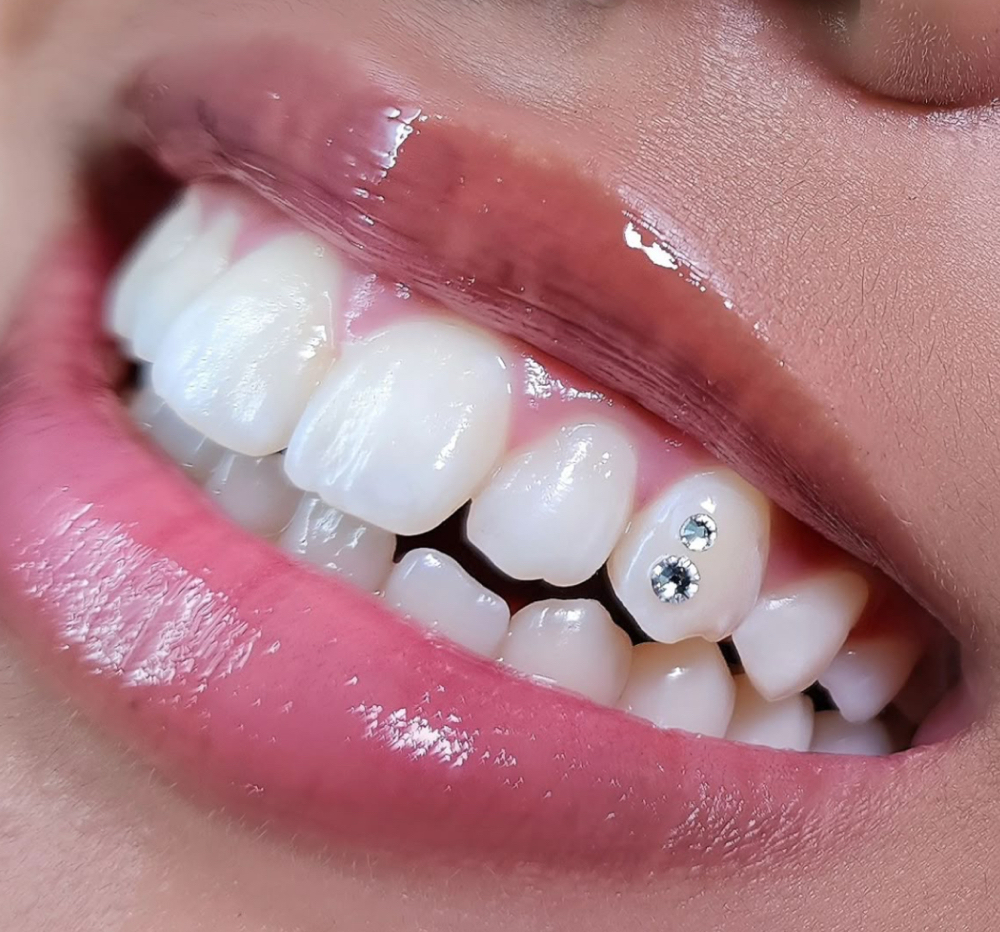 Tooth Gem