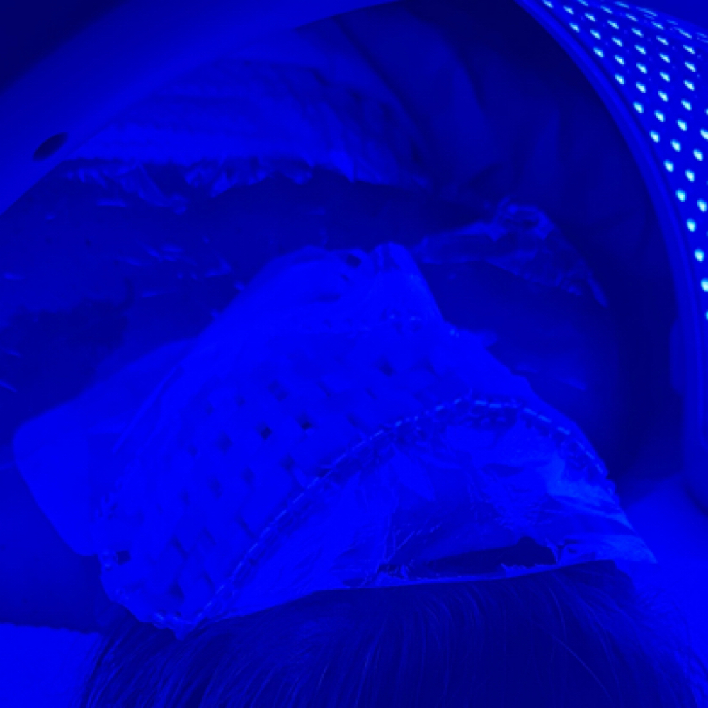 Clarity CO2 Facial at CLARITY WELLNESS Aesthetics in Canton, TX
