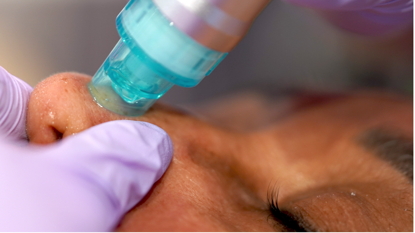 Hydro-Infusion Facial at Tae’s Esthétique Lounge in Jacksonville NC, NC