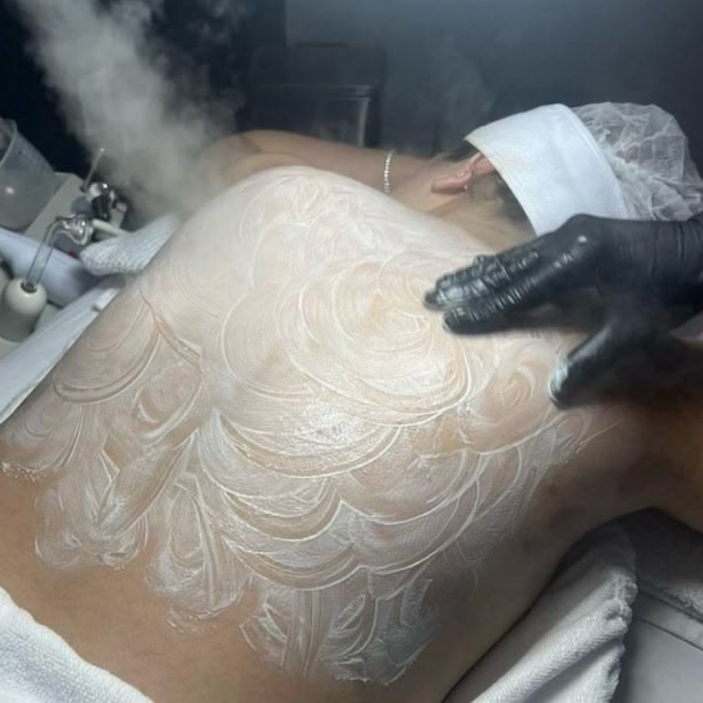 Back Facial at Golden Flower Esthetics in Weatherford, TX