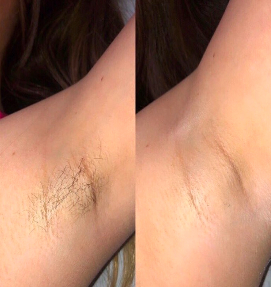 Underarm Wax
