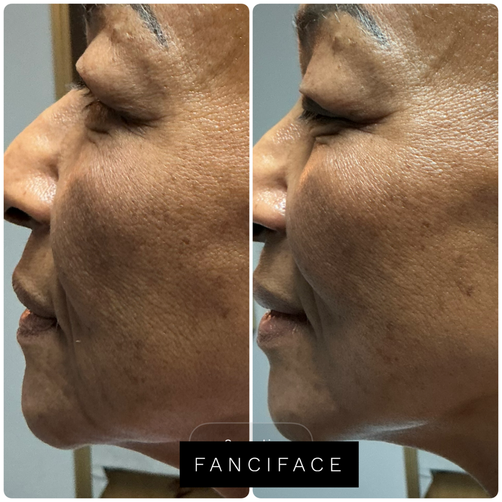 FanciFace at Knotty by Nature in Phoenix, AZ