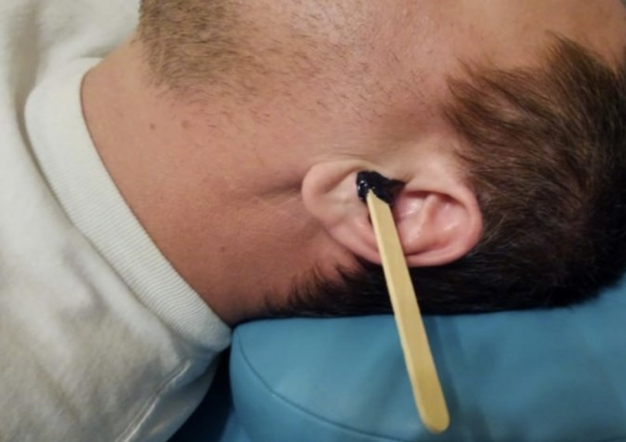 Ear Waxing