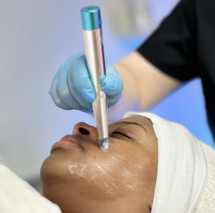 Rezenerate Nano Facial
