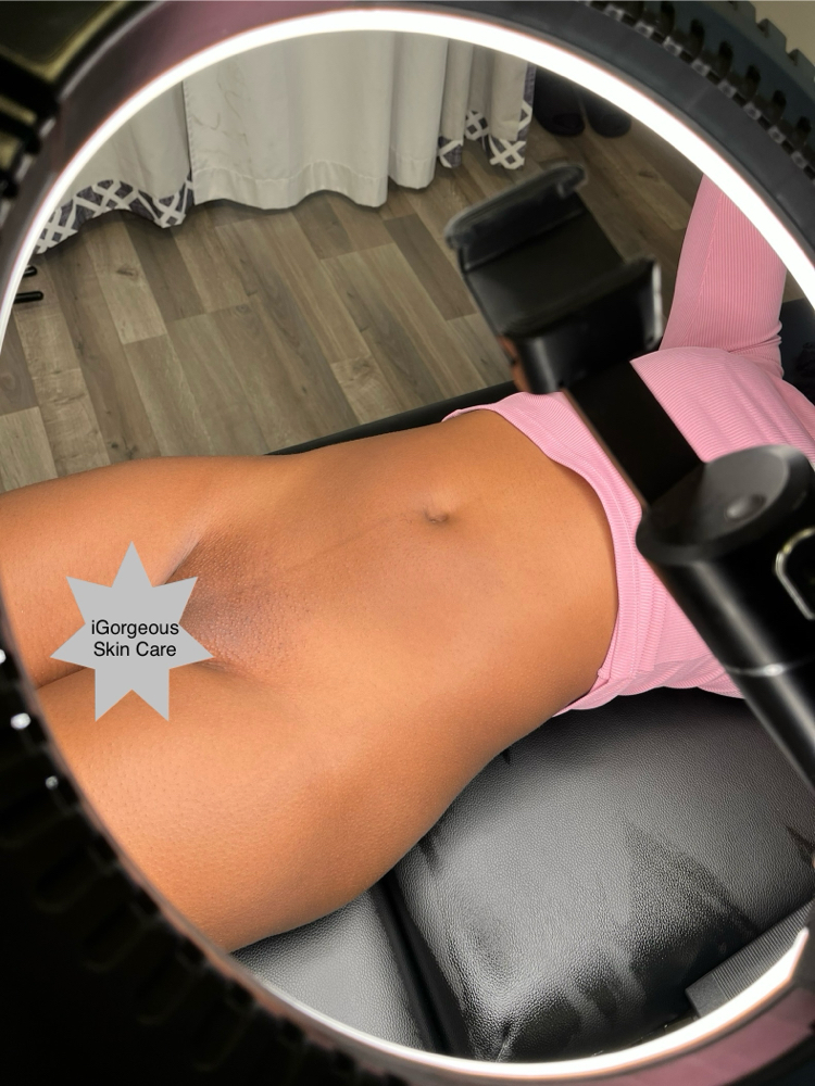 Brazilian wax