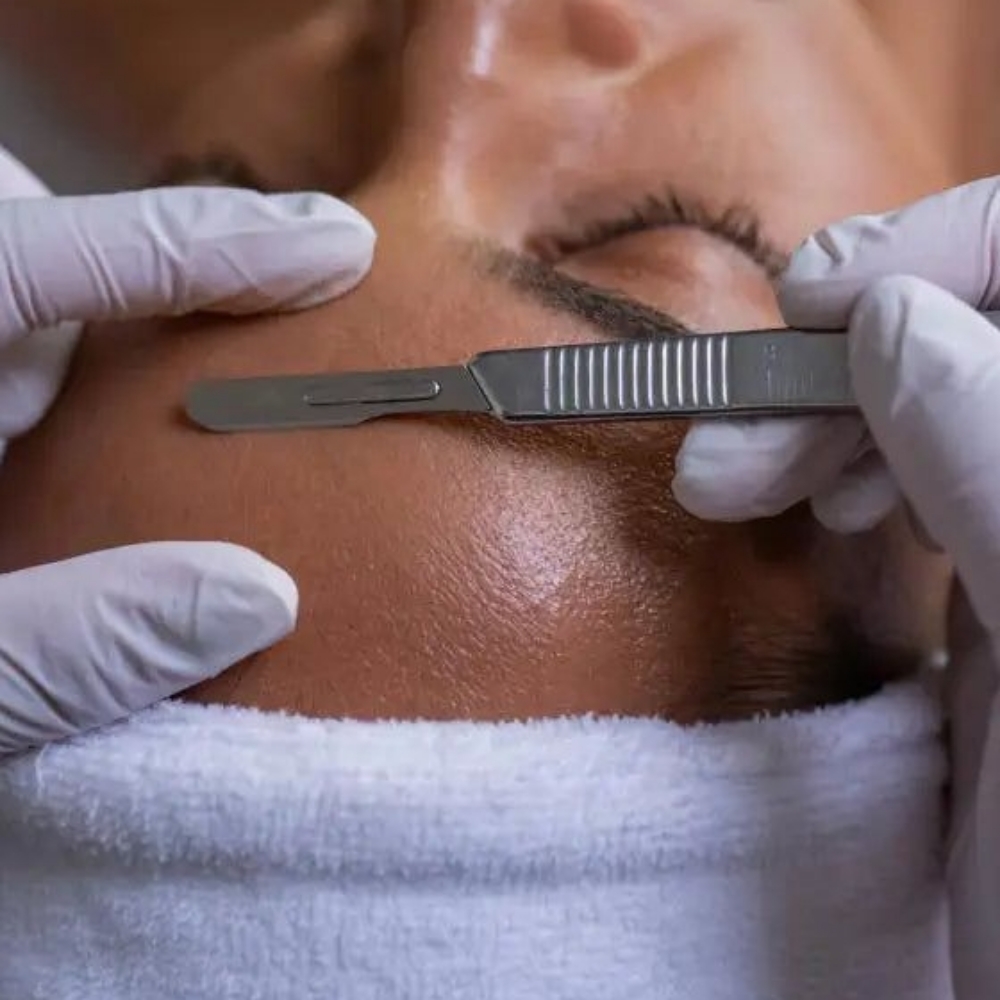 Dermaplaning at Haus of Glam by Karina J in Haverhill, FL