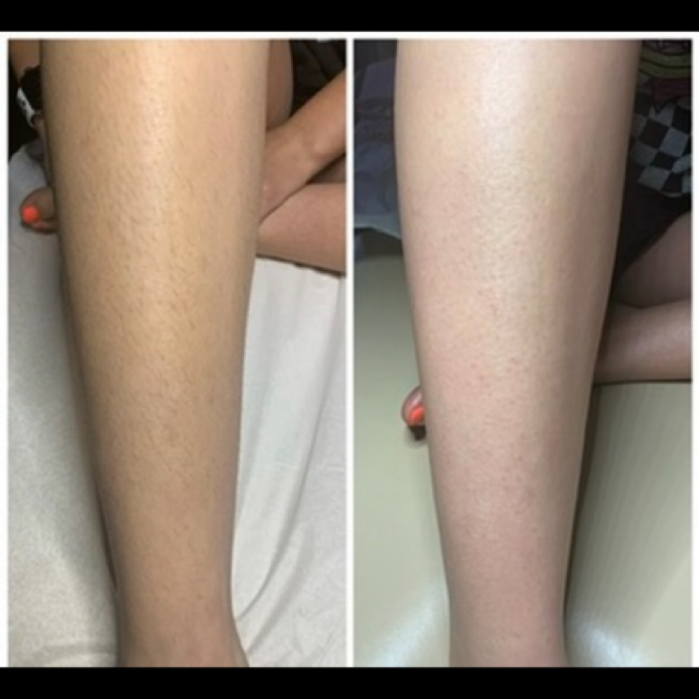 Lower Legs at Sweet Escape Studio in Matteson, IL