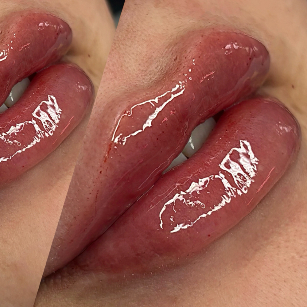 Lip Plumping Treatment 💋 at The Lash X Obsession in Lubbock, TX