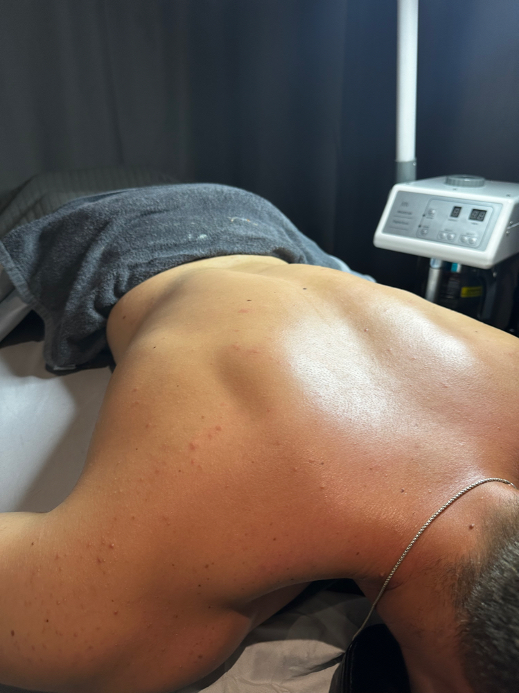 Custom Back Treatment