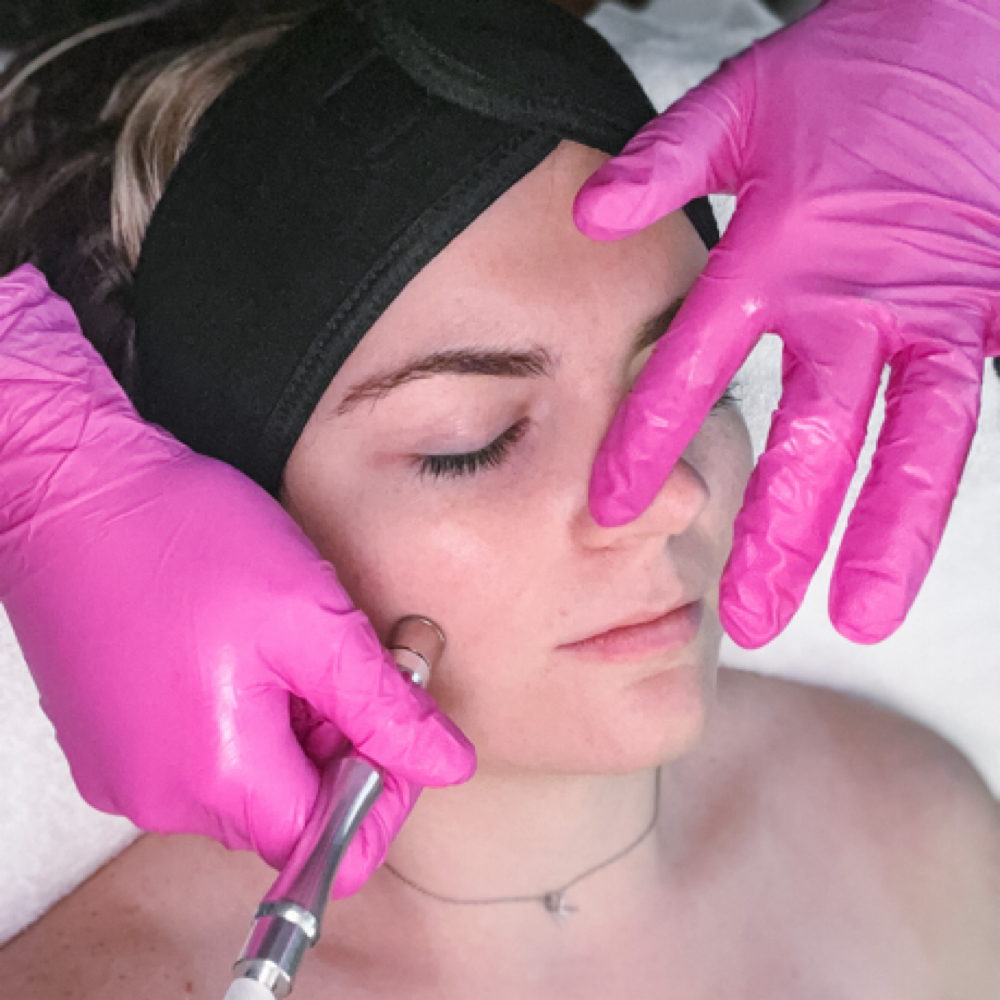 Microdermabrasion Facial at Luxury Esthetics LLC in Lewisburg, WV