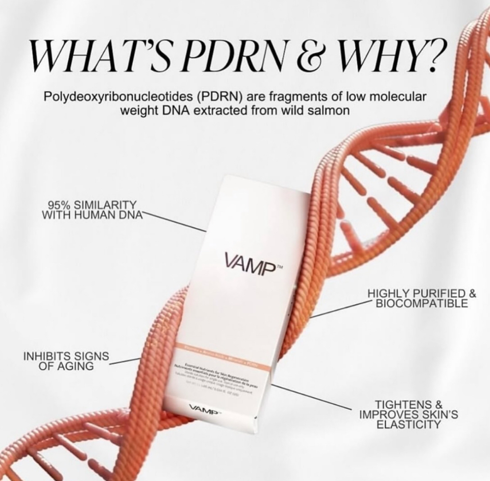 VAMP by Revanesse (3 sessions) at Glam By Nurse Am in Madisonville, TX