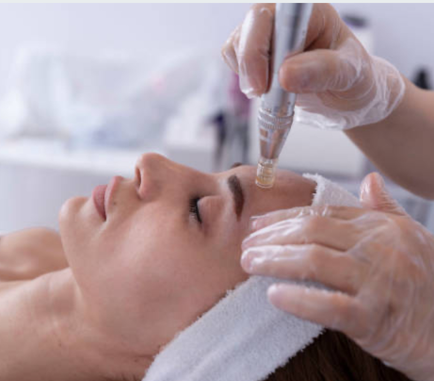 Microneedling