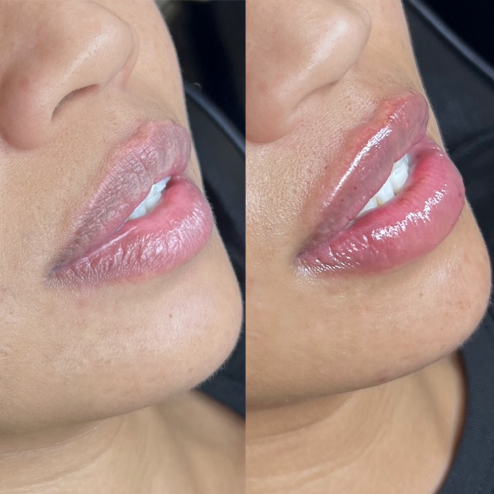 Lip Touch Ups / Maitenance