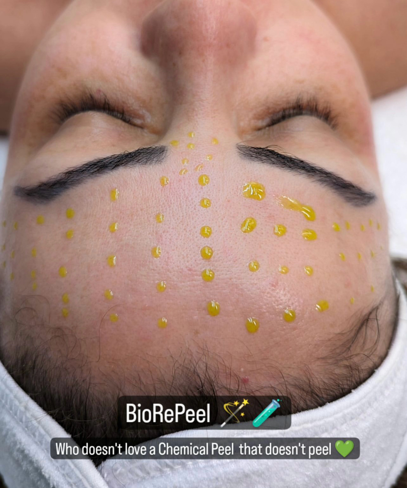 Biorepeel