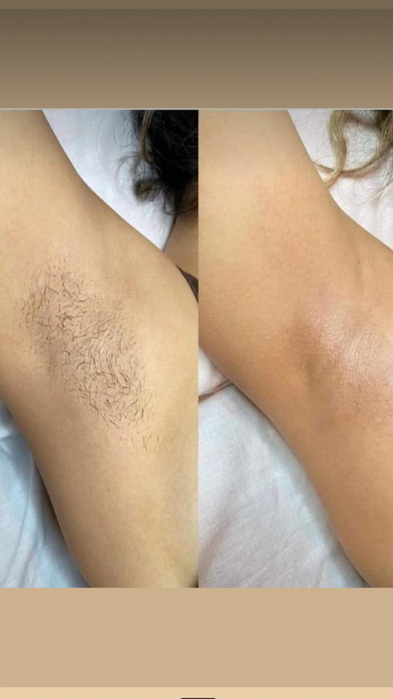 Under Arm Wax