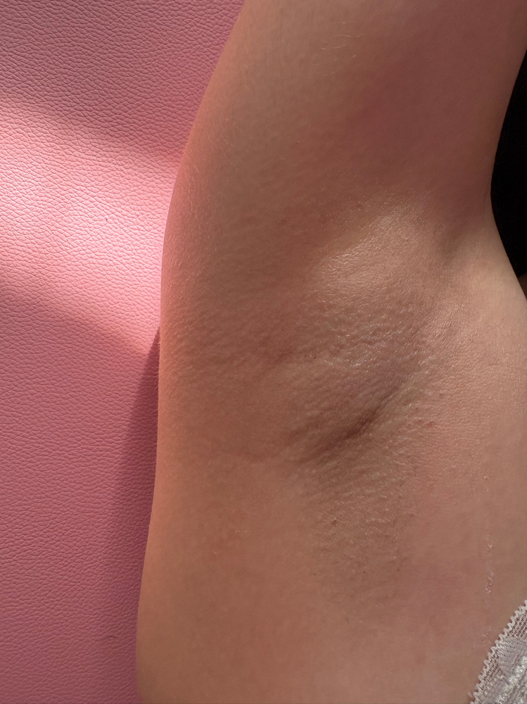 Underarm Wax