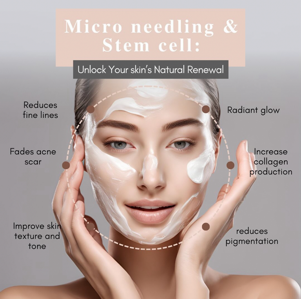 Microneedling & Plant Stem Cells 🌱 at STERLING INK & GLO in El Cajon, CA