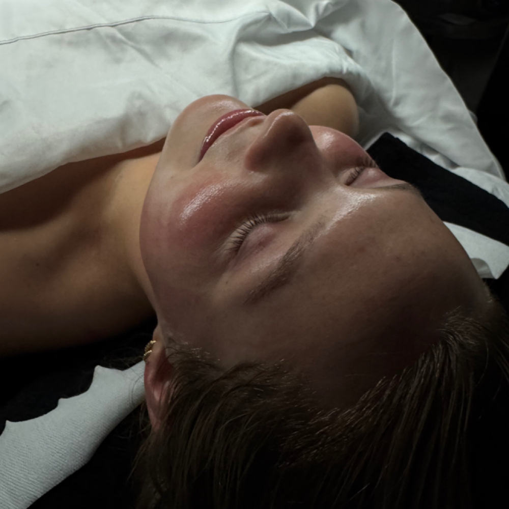 C.F. W/Dermaplane & High Frequency at Bae's Beauty Esthetics in Milan, TN