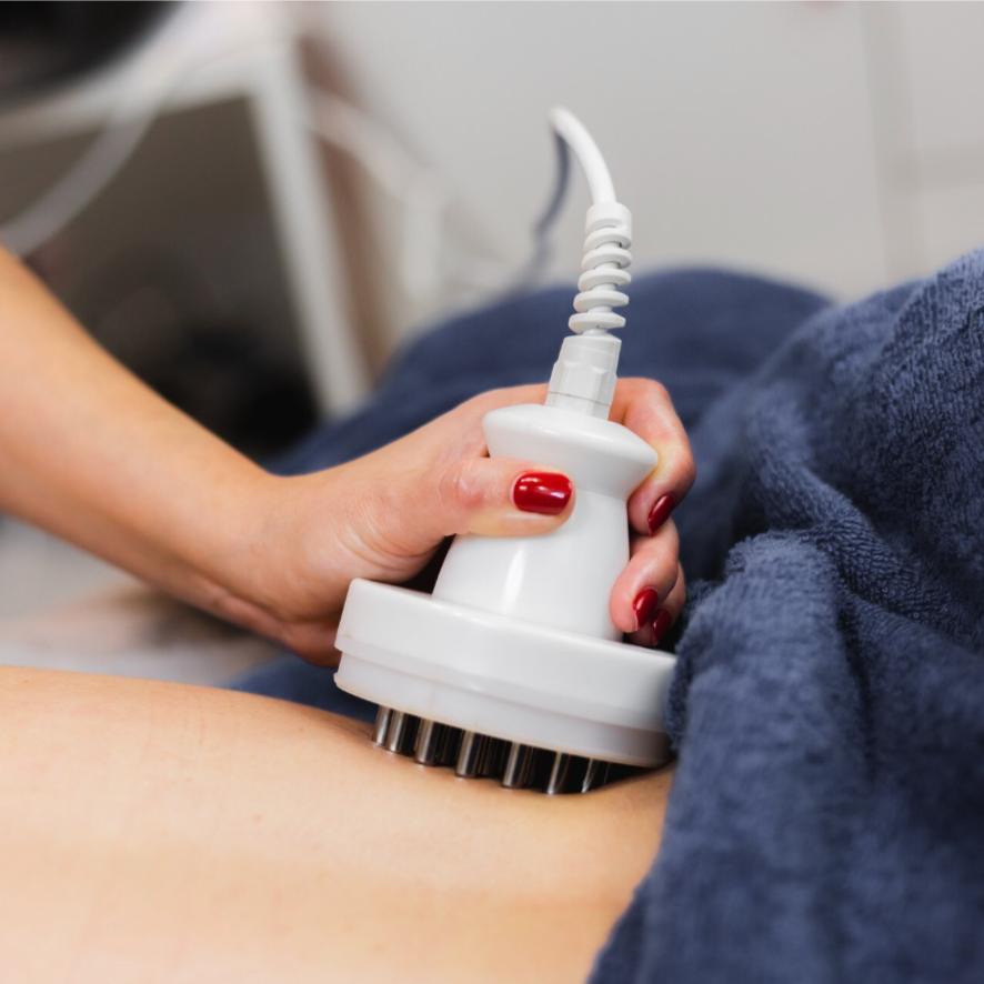 3 Week Package RF Body Reduction