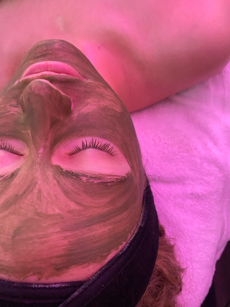Acne Facial