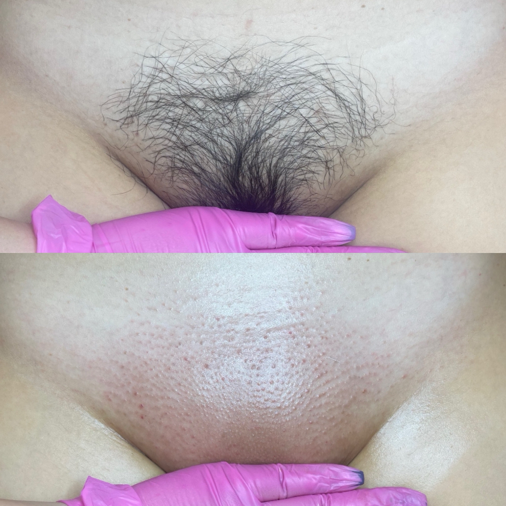 BOGO Bestie Brazilian Wax at Pink Crab Wax Bar in Las Vegas, NV