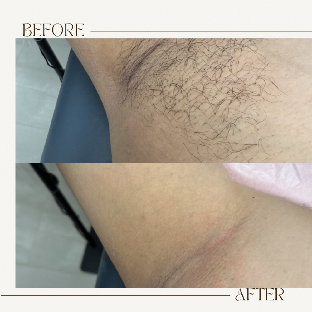 Underarms (armpits) wax at Lash&Glo in Boerne, TX